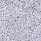 Immunohistochemical staining of human liver shows no positivity in hepatocytes as expected.