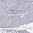 Immunohistochemical staining of human skeletal muscle shows no positivity in myocytes as expected.