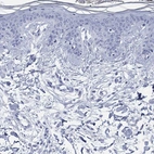 Immunohistochemical staining of human skin shows no positivity in squamous epithelial cells as expected.