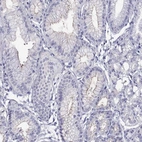 Immunohistochemical staining of human stomach shows weak membranous positivity in glandular cells.