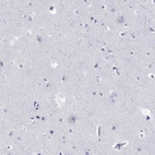 Immunohistochemical staining of human cerebral cortex shows no positivity in neurons as expected.