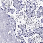 Immunohistochemical staining of human placenta shows no positivity in trophoblastic cells as expected.
