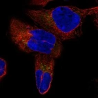 Immunofluorescent staining of human cell line RH-30 shows localization to cytosol & vesicles.