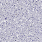 Immunohistochemical staining of human liver shows no positivity in hepatocytes as expected.