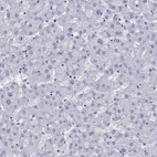 Immunohistochemical staining of human liver shows no positivity in hepatocytes as expected.