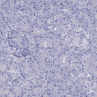 Immunohistochemical staining of human pancreas shows no positivity in exocrine glandular cells as expected.