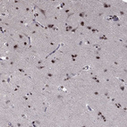 Immunohistochemical staining of human cerebral cortex shows strong cytoplasmic positivity in neuronal cells and glial cells.