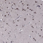 Immunohistochemical staining of human cerebral cortex shows strong cytoplasmic positivity in neuronal cells and glial cells.