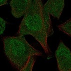 Immunofluorescent staining of human cell line RH-30 shows localization to nucleoplasm & cytosol.