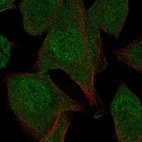 Immunofluorescent staining of human cell line RH-30 shows localization to nucleoplasm & cytosol.
