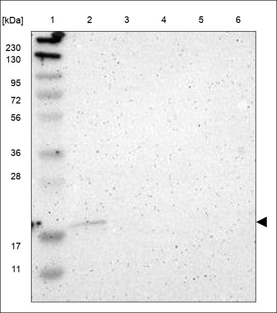 Anti-ARF6 Antibody