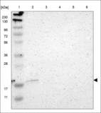 Anti-ARF6 Antibody