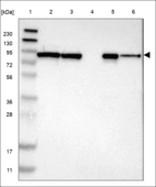 Anti-ACO2 Antibody