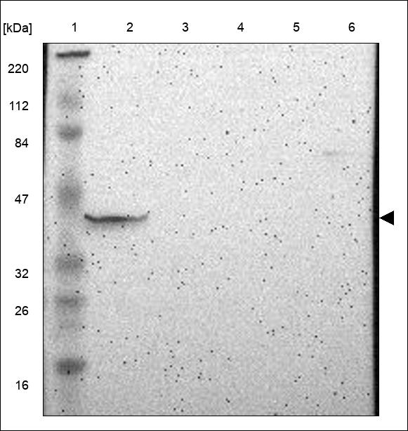 Anti-FBXO25 Antibody