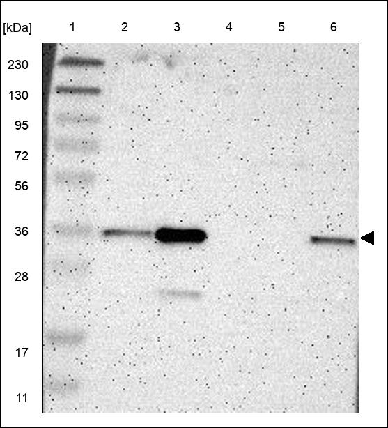 Anti-FANCF Antibody