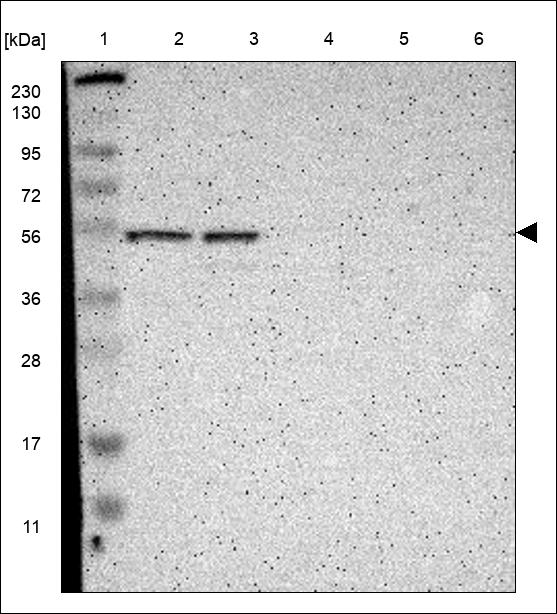 Anti-CALCRL Antibody