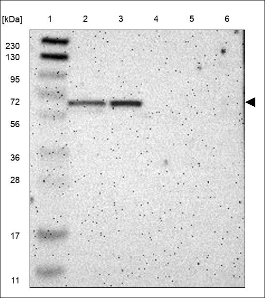 Anti-KDM4D Antibody