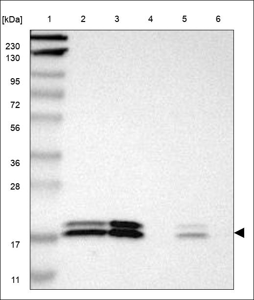 Anti-NME1 Antibody