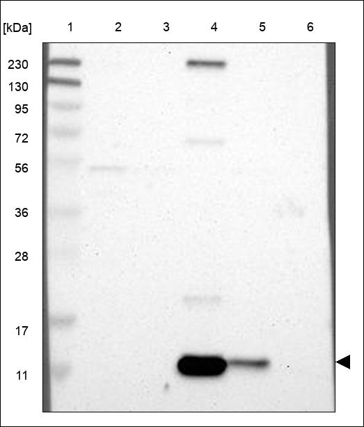 Anti-PPBP Antibody