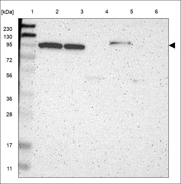 Anti-ZNF512B Antibody