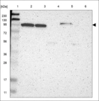 Anti-ZNF512B Antibody