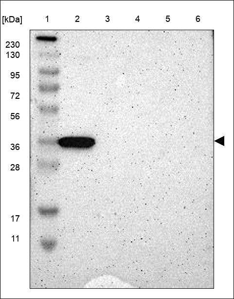 Anti-ATF4 Antibody