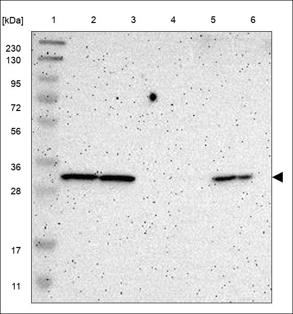 Anti-TPM3 Antibody