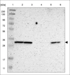 Anti-TPM3 Antibody