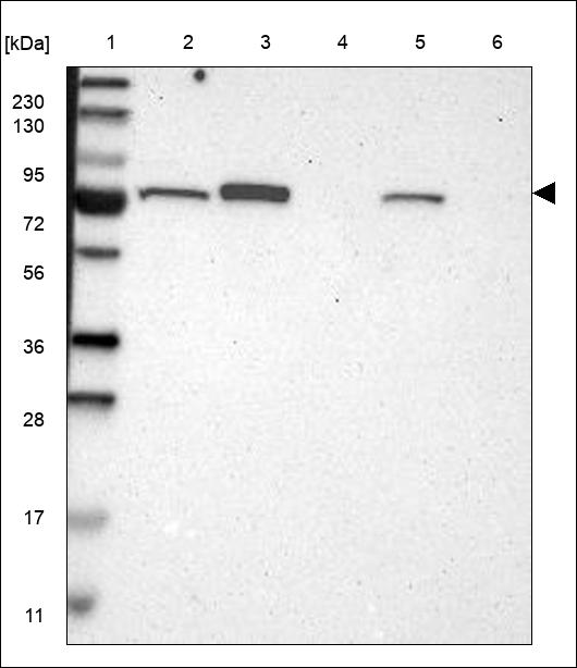 Anti-NTN4 Antibody
