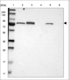 Anti-NTN4 Antibody