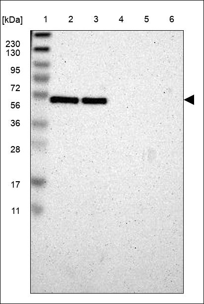 Anti-RBM22 Antibody