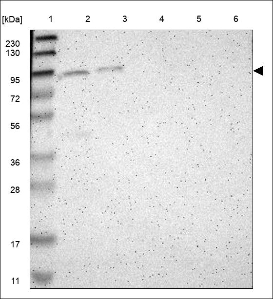 Anti-PCDHB2 Antibody