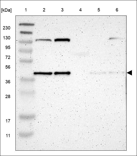 Anti-DNAJB11 Antibody