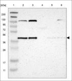 Anti-DNAJB11 Antibody