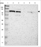 Anti-B4GALNT3 Antibody