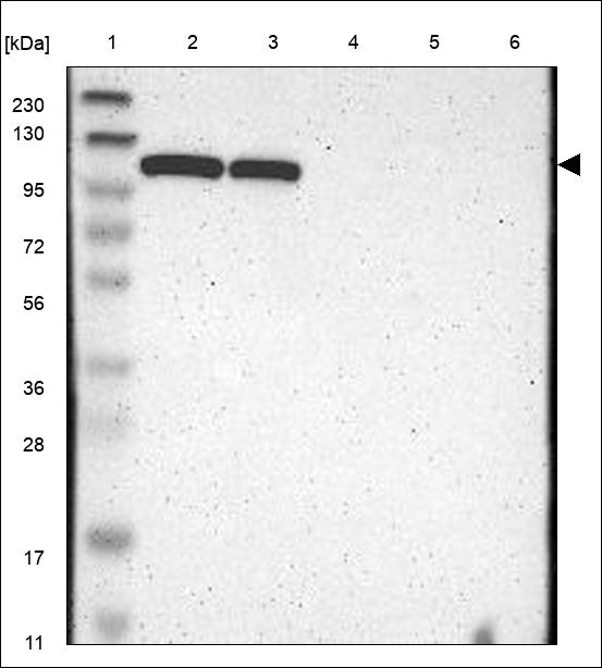 Anti-HKDC1 Antibody