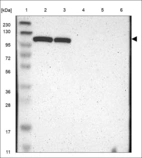 Anti-HKDC1 Antibody