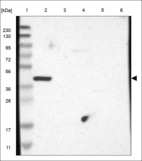 Anti-ATF4 Antibody