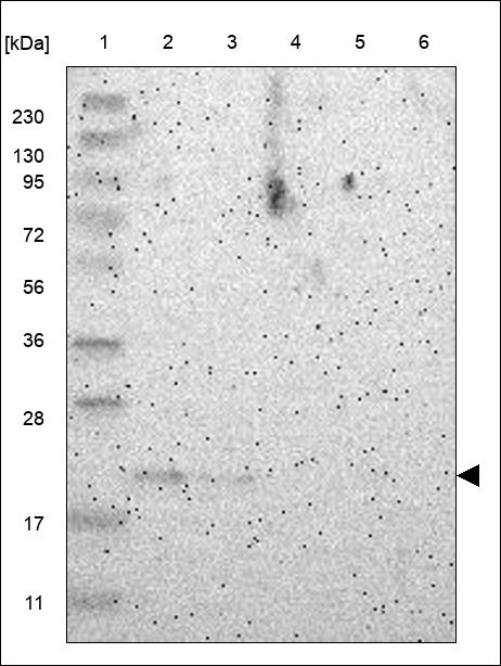 Anti-CARD19 Antibody