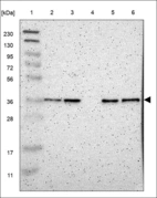 Anti-LDLRAD3 Antibody