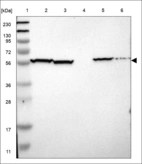 Anti-C17orf80 Antibody