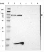 Anti-GLANT8 Antibody