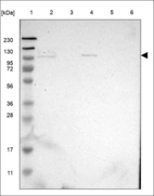 Anti-SEMA4B Antibody