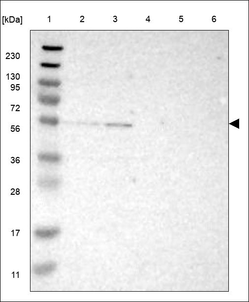 Anti-DRD5 Antibody