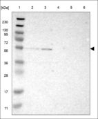 Anti-DRD5 Antibody