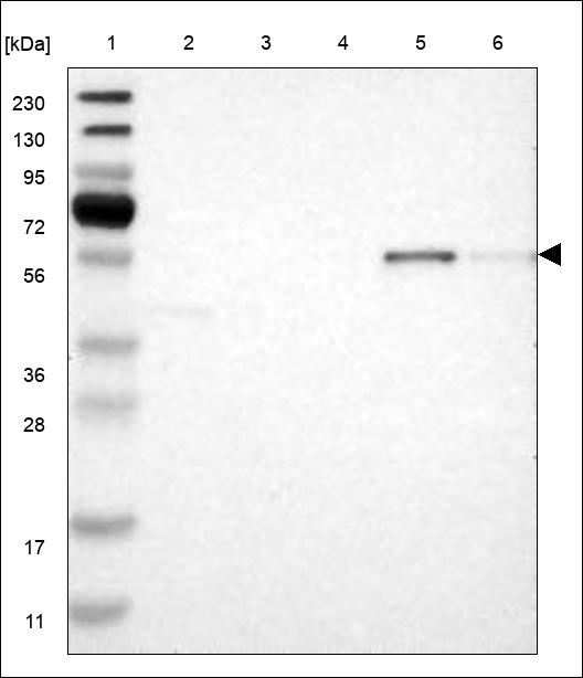 Anti-LAG3 Antibody