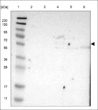 Anti-ABHD15 Antibody