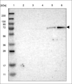 Anti-TRIM47 Antibody