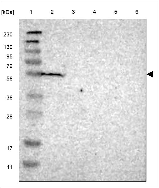 Anti-KCNK5 Antibody
