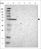 Anti-KCNK5 Antibody